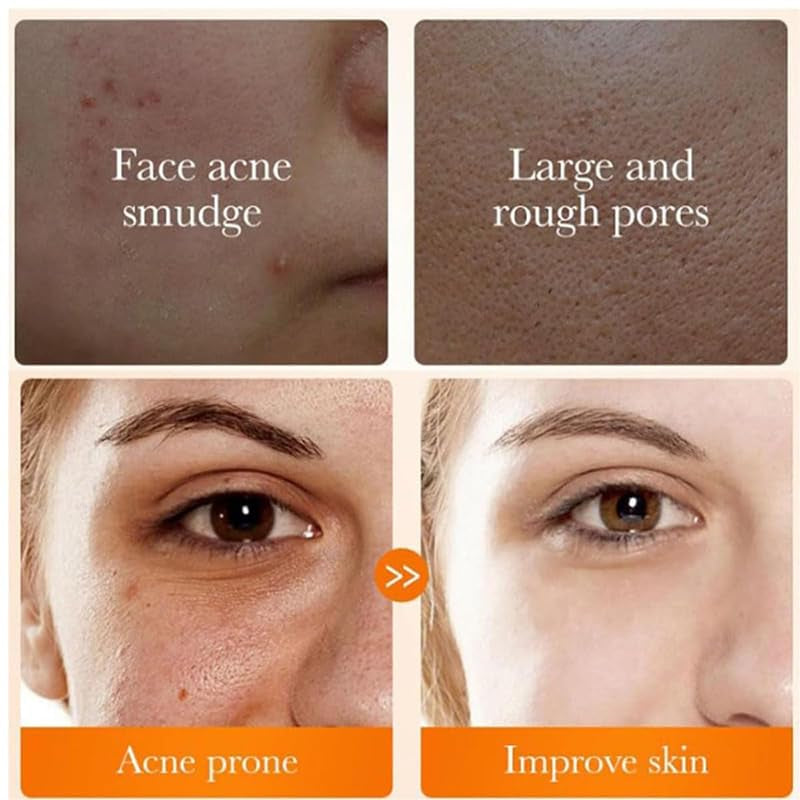 2 Pcs Hoygi Turmeric Kojic Acid Foaming Face Wash, Glow Wash Turmeric Face Wash with Brush Turmeric Foaming Facial Deep Cleansing Scrub Exfoliating.