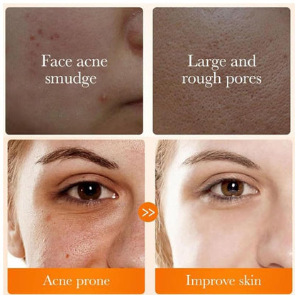 2 Pcs Hoygi Turmeric Kojic Acid Foaming Face Wash, Glow Wash Turmeric Face Wash with Brush Turmeric Foaming Facial Deep Cleansing Scrub Exfoliating.